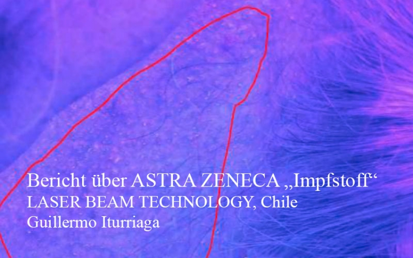 AstraZeneca Bericht Laser Beam Technology Chile